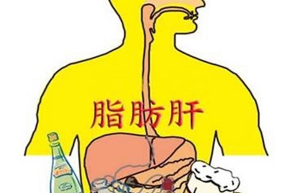 脂肪肝的食疗效果及（通过合理饮食控制改善脂肪肝症状）